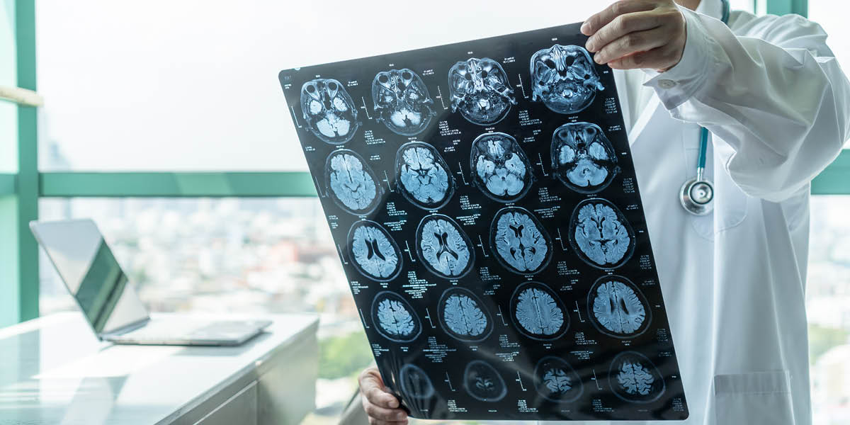Neurological - A doctor examining an MRI of a brain